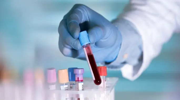 تحليل S. Albumin: دليلك الشامل لفهم هذا الفحص الحيوي ونتائجه