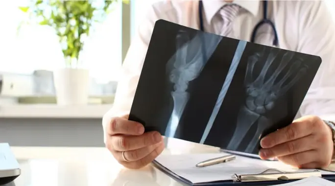 آلام العظام بعد العلاج الكيماوي: دليلك الشامل لفهمها والتخفيف منها