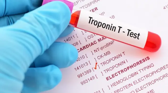 الفرق بين Troponin I وTroponin T: دليل شامل لصحة قلبك