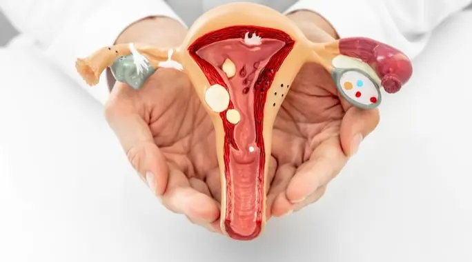 مضاعفات قرحة عنق الرحم: دليلك الشامل للوقاية والعلاج