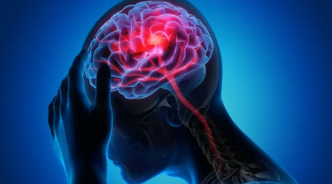 هجوم نقص التروية العابرة (TIA): لا تتجاهل هذه &#8220;السكتة المصغرة&#8221; &#8211; الأسباب والأعراض والعلاج