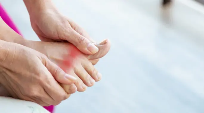 هل النقرس مرض مزمن حقاً؟ دليل شامل لفهم وإدارة هذا المرض