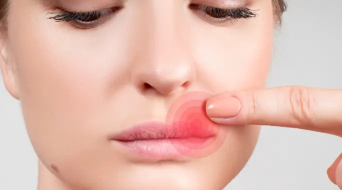 حبوب الشفاه: دليل شامل لأسبابها، أنواعها، وطرق علاجها الفعالة
