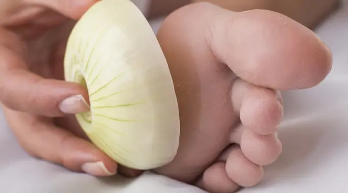 البصل لعلاج مسمار القدم: خرافة أم حقيقة؟ دليل شامل للوصفات والوقاية