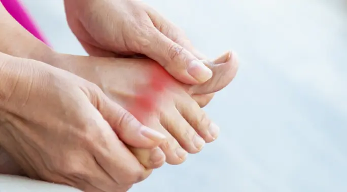 هل مرض النقرس خطير؟ وما هي أفضل طرق العلاج والوقاية؟