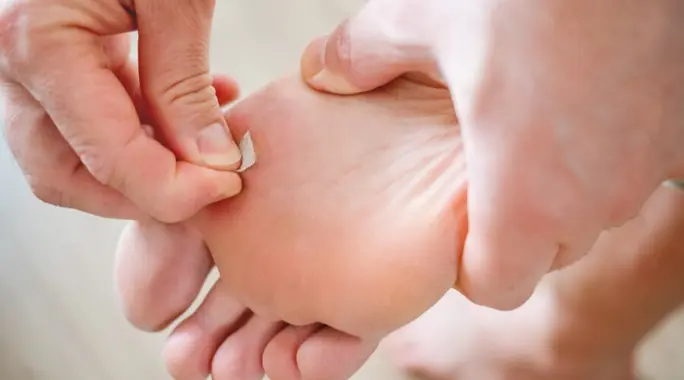 لصقات مسمار القدم: دليلك الشامل للاستخدام الفعال وتجنب المخاطر