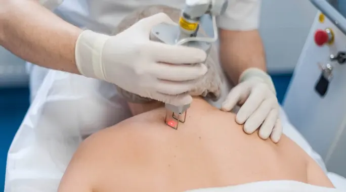 علاج البقع البنية في الظهر: دليل شامل للتخلص منها واستعادة صفاء بشرتك
