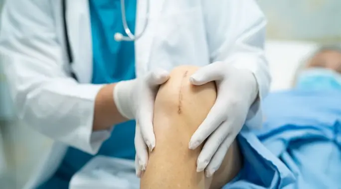 متى يلتئم جرح عملية المنظار؟ دليل شامل للتعافي السريع والرعاية المنزلية