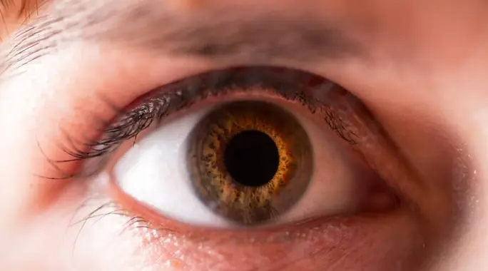Macular Edema: Understanding This Vision-Threatening Eye Condition