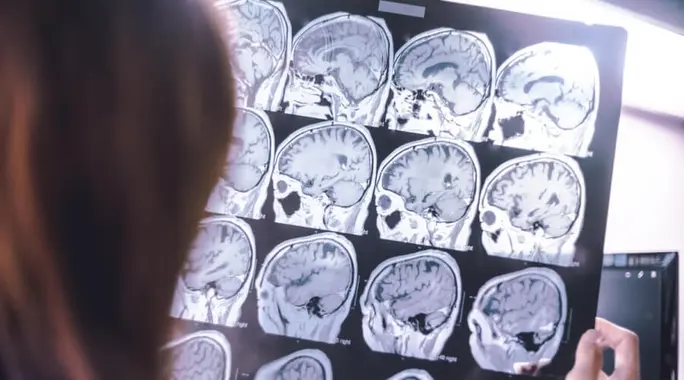 الفرق بين الخرف والزهايمر: دليل شامل لفهم الفروقات الأساسية