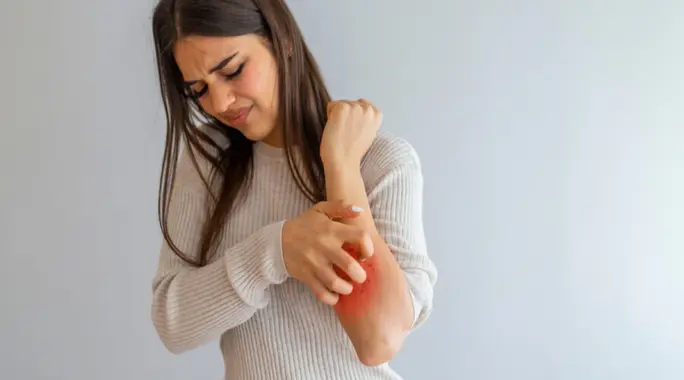 Don&#8217;t Ignore the Itch: When Is Itching Serious and What to Do