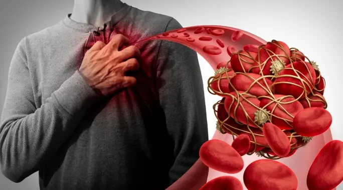 هل تخثر الدم خطير حقاً؟ دليلك الشامل للمخاطر، الأعراض والوقاية