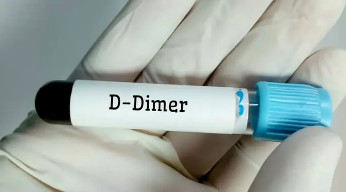 دليلك الشامل: فهم تحليل D-dimer والمعدل الطبيعي لنتائجه