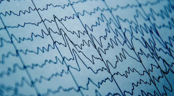 كهرباء المخ عند الأطفال: هل يمكن الشفاء منها نهائياً؟ دليل شامل للوالدين