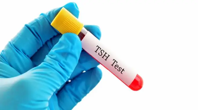 النسبة الطبيعية للغدة الدرقية TSH: دليل شامل لفهم نتائج فحصك