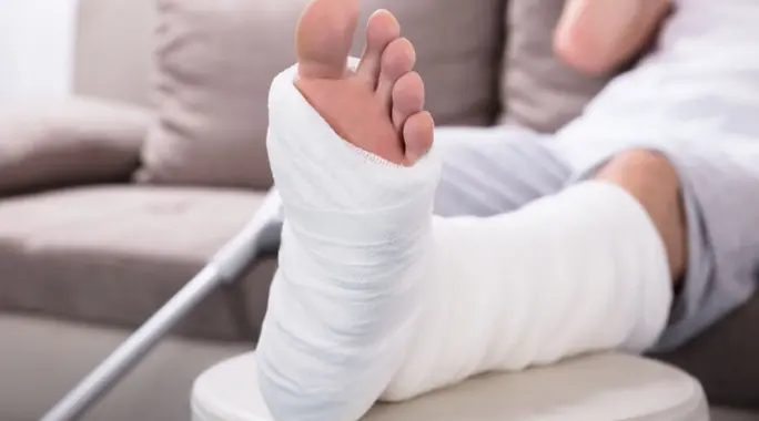 أسباب فشل التئام العظام بعد الجبس: دليلك الشامل لتعزيز الشفاء