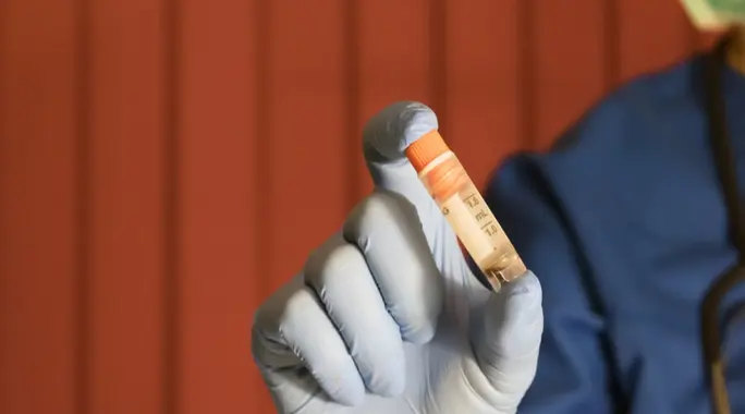 Stem Cell Transplantation: A Comprehensive Guide to This Life-Saving Treatment