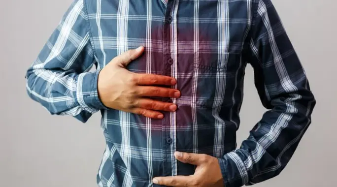 علاج الحموضة والحرقان بالمنزل: دليلك الشامل لتخفيف حرقة المعدة بفعالية