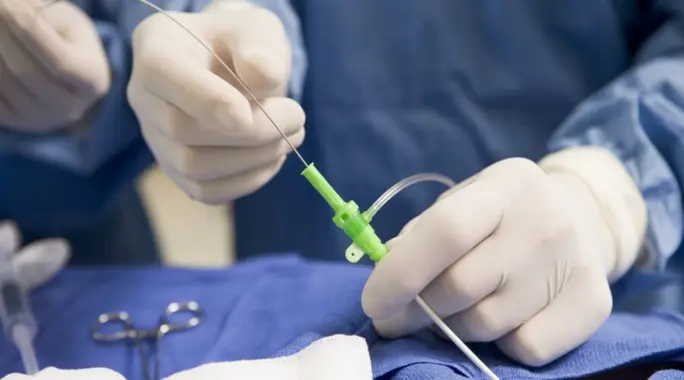 القسطرة القلبية: دليل شامل لفهم كيف تتم العملية والتعافي منها