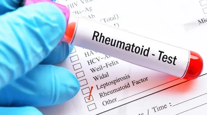 ما هو تحليل Rheumatoid Factor؟ دليلك الشامل لفهم عامل الروماتويد