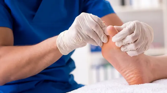 عملية مسمار القدم: دليل شامل لإزالة الألم واستعادة راحة قدميك