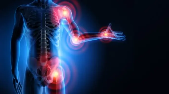 ما هو الروماتيزم حقًا؟ فهم شامل للأعراض والأنواع وطرق العلاج