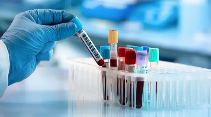 هل ارتفاع هرمون الحليب خطير حقاً؟ دليلك الشامل للمضاعفات والعلاج