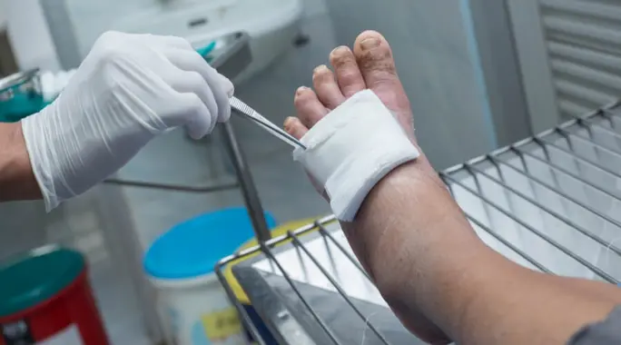 أدوية القدم السكري: دليل شامل للعلاج والوقاية