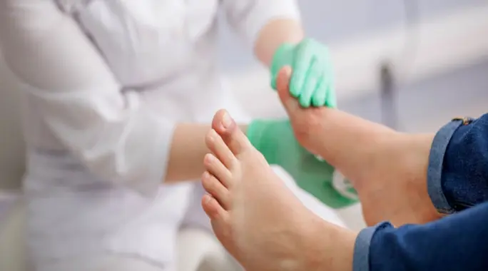 علاج الصديد في القدم السكري: دليل شامل للوقاية والعلاج الفعال