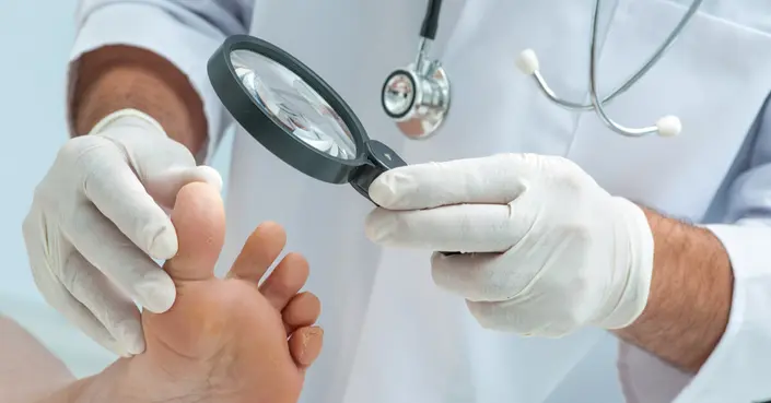 إصبع السكري: فهم الأعراض، الأسباب، والعلاج الفعال