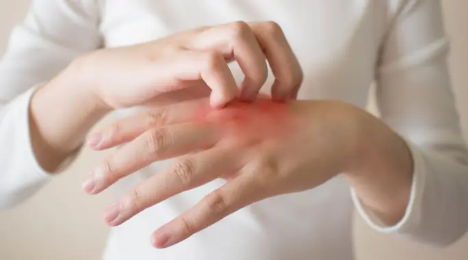 وداعاً للحكة المزعجة: دليلك الشامل لـ كيفية التخلص من حكة الجسم