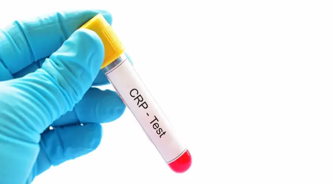 المعدل الطبيعي لتحليل CRP: دليل شامل لفهم نتائجك الصحية