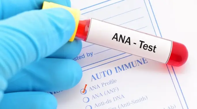 ما هو تحليل ANA؟ دليلك الشامل لفهم اختبار الأجسام المضادة للنواة ونتائجه