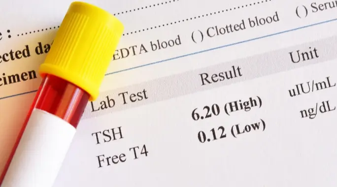 تحليل TSH مرتفع: فهم دلالاته، أسبابه، وأعراضه الرئيسية