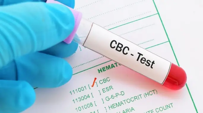 ما هو تحليل CBC؟ دليلك الشامل لفهم تعداد الدم الكامل وأهميته لصحتك