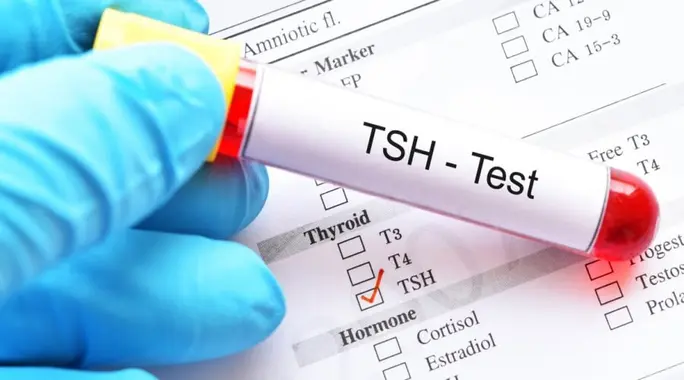 تحليل TSH للرجال: دليلك الشامل لفهم النتائج وصحة الغدة الدرقية