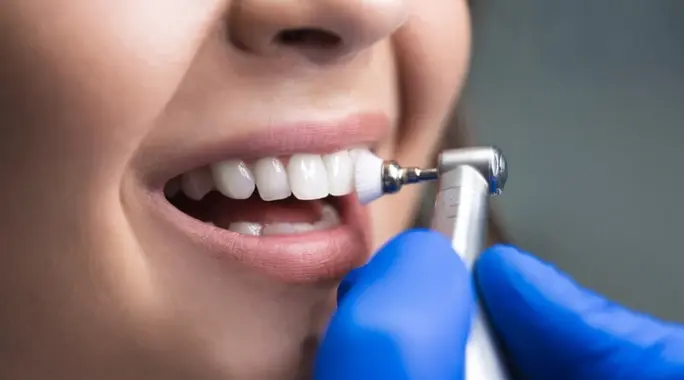 أضرار تنظيف الأسنان: ما يجب أن تعرفه عن الآثار الجانبية المحتملة