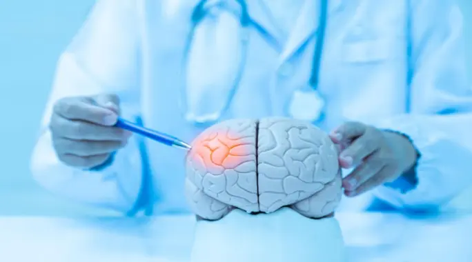 السكتة الدماغية: دليلك الشامل لتقليل عوامل الخطر والوقاية منها بفعالية