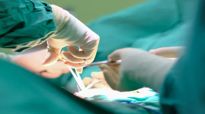 كيف أعرف أن عملية الفتاق نجحت؟ دليلك الشامل لعلامات التعافي والرعاية بعد الجراحة