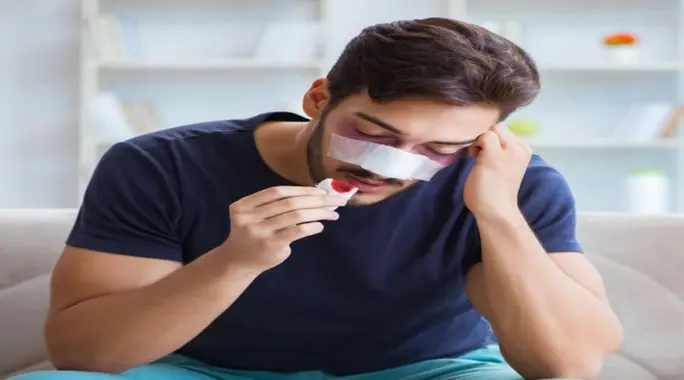هل نزيف الأنف بعد عملية اللحمية طبيعي؟ دليلك الشامل للأسباب والحلول