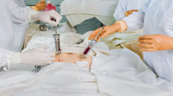 عملية زرع النخاع لمرضى سرطان الدم: أمل جديد في مواجهة المرض