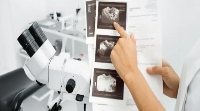 كم تستغرق عملية تنظيف الرحم؟ دليل شامل للمدة، الإجراء، والتعافي