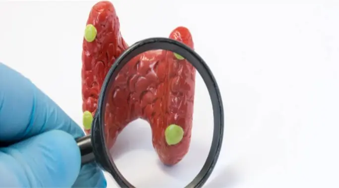 Unveiling Parathyroid Gland Symptoms: Your Comprehensive Guide to Hyperparathyroidism