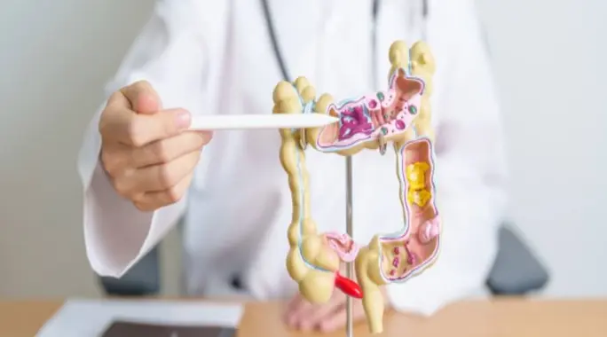 علاج التهاب الرتج في المنزل: دليل شامل لتخفيف الأعراض والوقاية