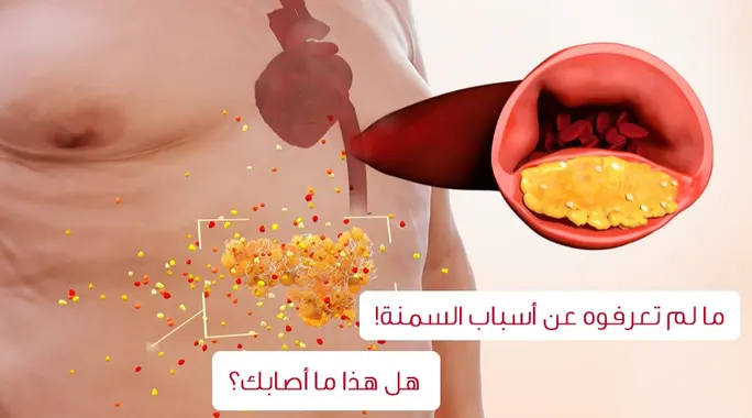 أكثر من مجرد طعام ورياضة: اسباب غير متوقعة للسمنة ستفاجئك