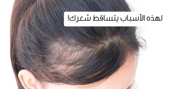تخلصي من القلق: أهم أسباب تساقط الشعر لدى النساء والعلاج الفعال