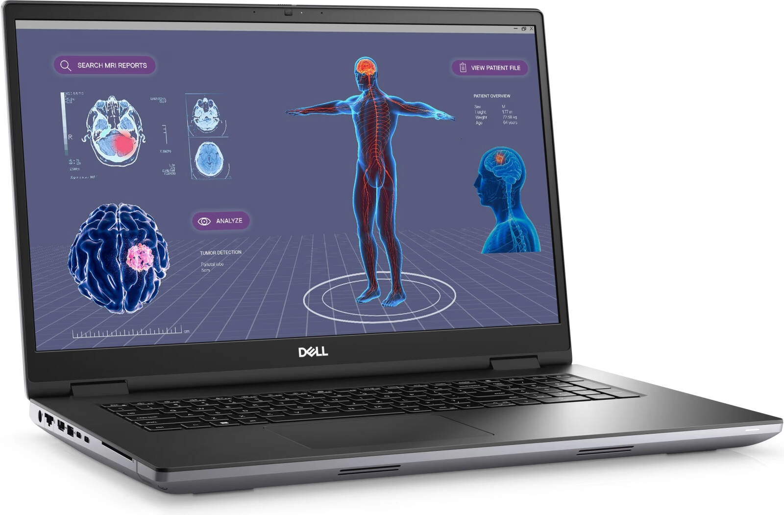 Dell Precision 7780 Workstation Laptop Review: Powerful Performance with Trade-offs
